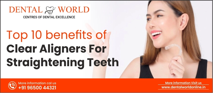 Benefits of clear aligners for straightening of teeth