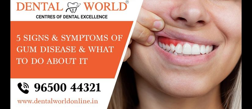 Sign and symptoms of gum disease 