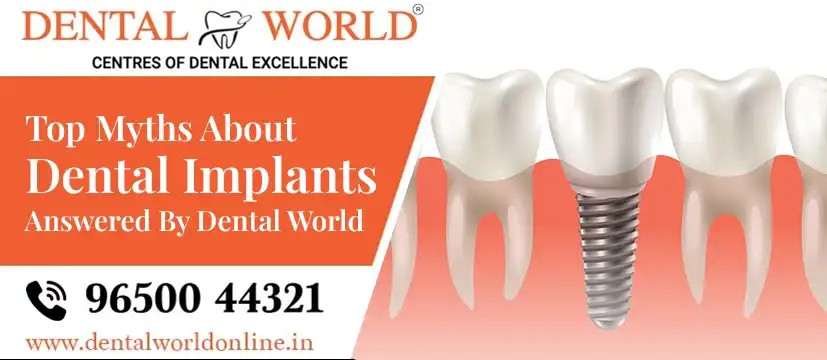 myths about dental implants